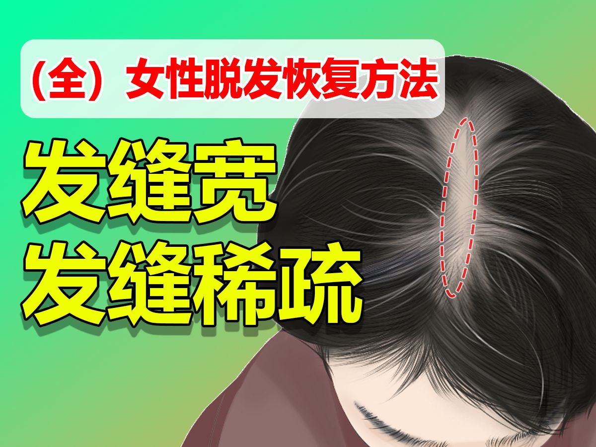 【全】发缝宽、发缝稀疏恢复方法,建议收藏!哔哩哔哩bilibili