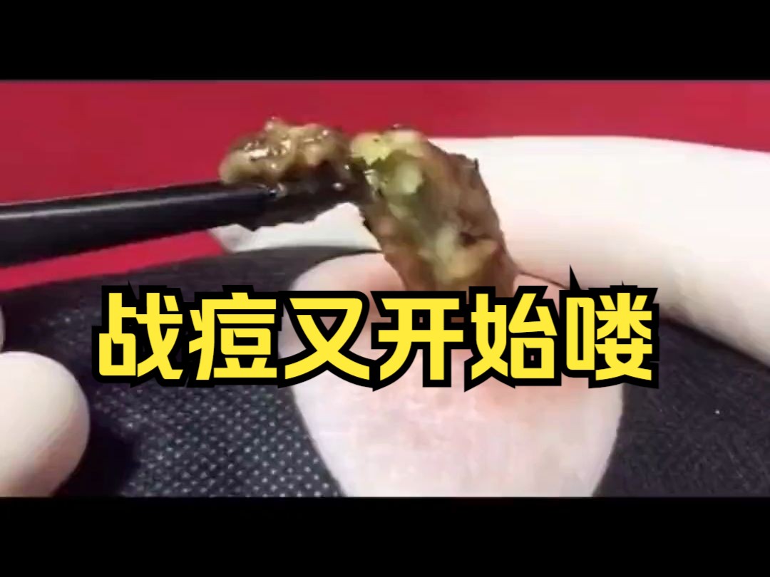 重口味视觉冲击,引人不适请谨慎观看!哔哩哔哩bilibili