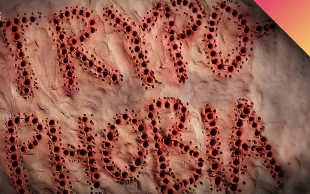 你害怕洞洞吗告诉你密集恐惧症的成因慎入