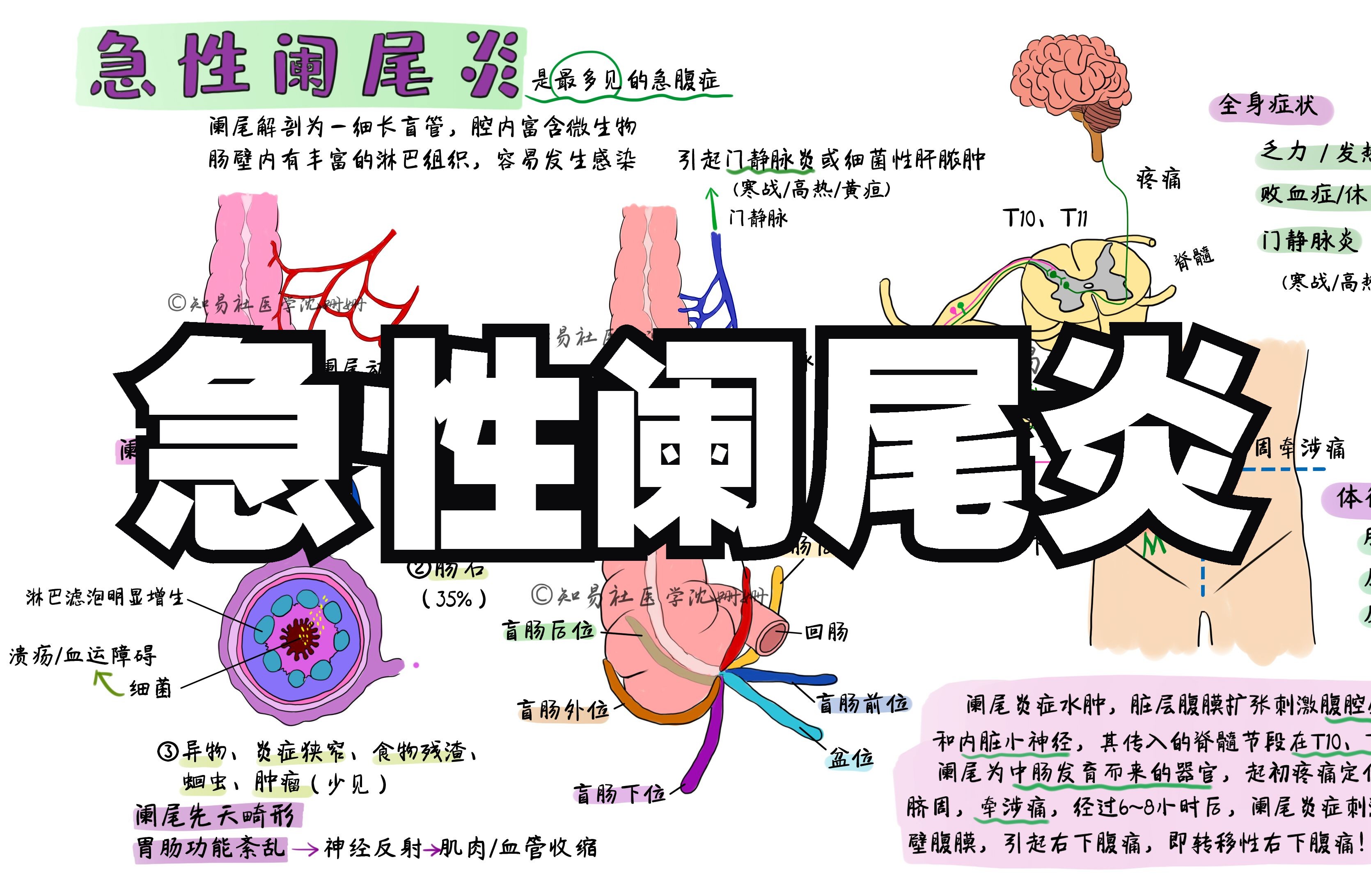 医学带背 急性阑尾炎 | 病因机制+症状体征+诊断+治疗哔哩哔哩bilibili