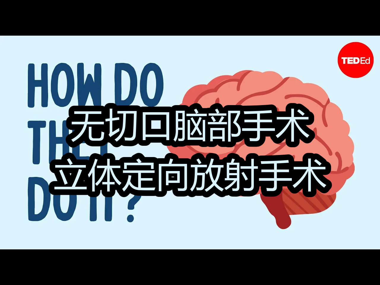 【中配】无切口脑部手术:立体定向放射手术  TEDEd哔哩哔哩bilibili