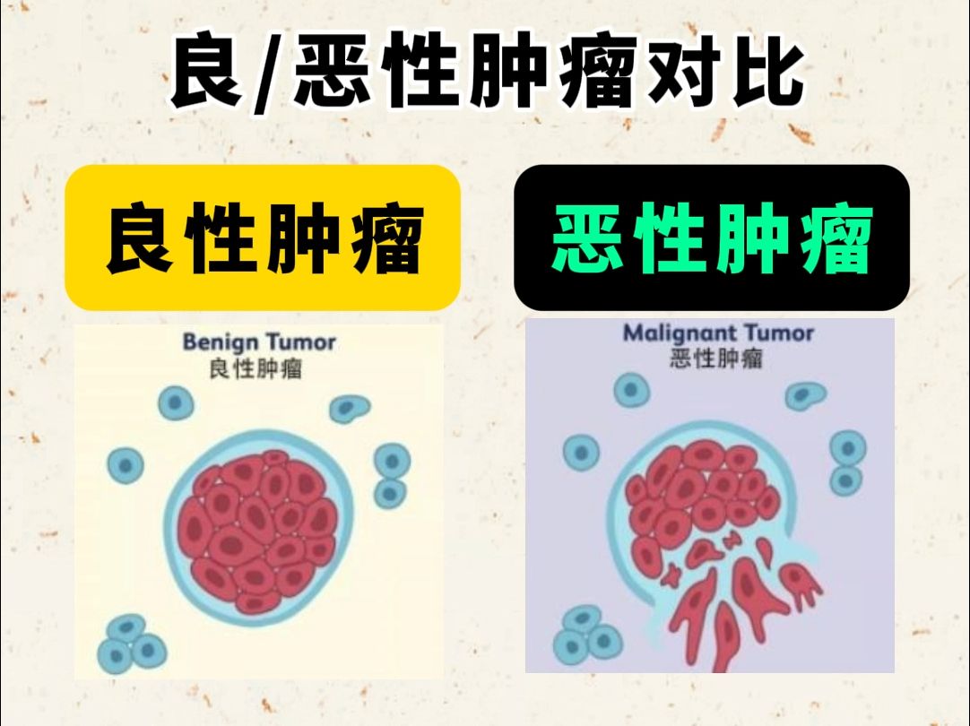 恶性肿瘤图片排名图片