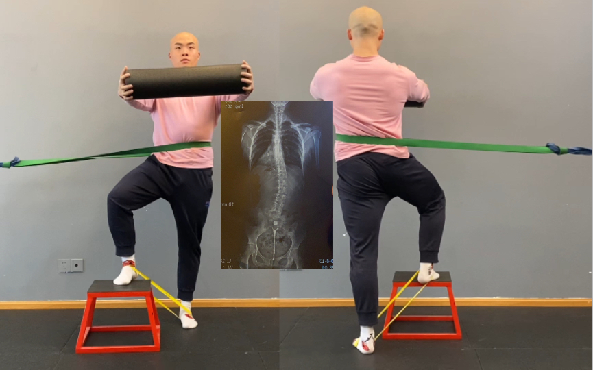 【硬核体态矫正】腰椎大侧弯的站立位矫正训练,坚持下来的都没有理由