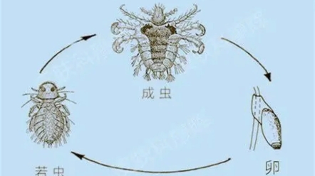 去阴虱子最简单的方法图片