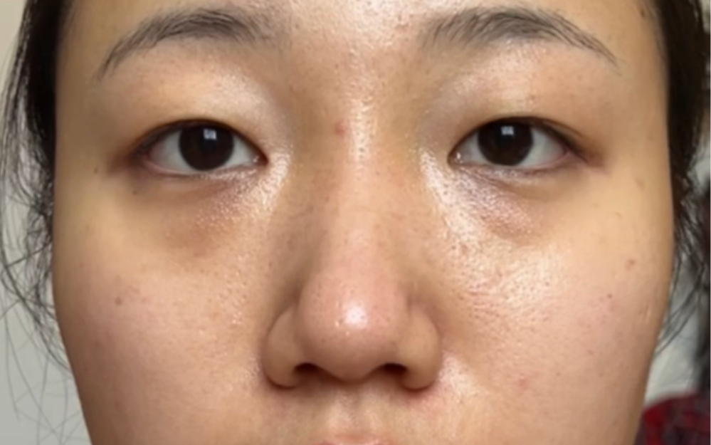 普通瑕疵皮女生想要美美的出门要做哪些努力?