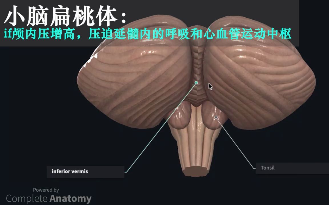 【人解三分钟】小脑的3D结构:小脑蚓小脑扁桃体原裂水平裂绒球和小结,他们在那里?哔哩哔哩bilibili