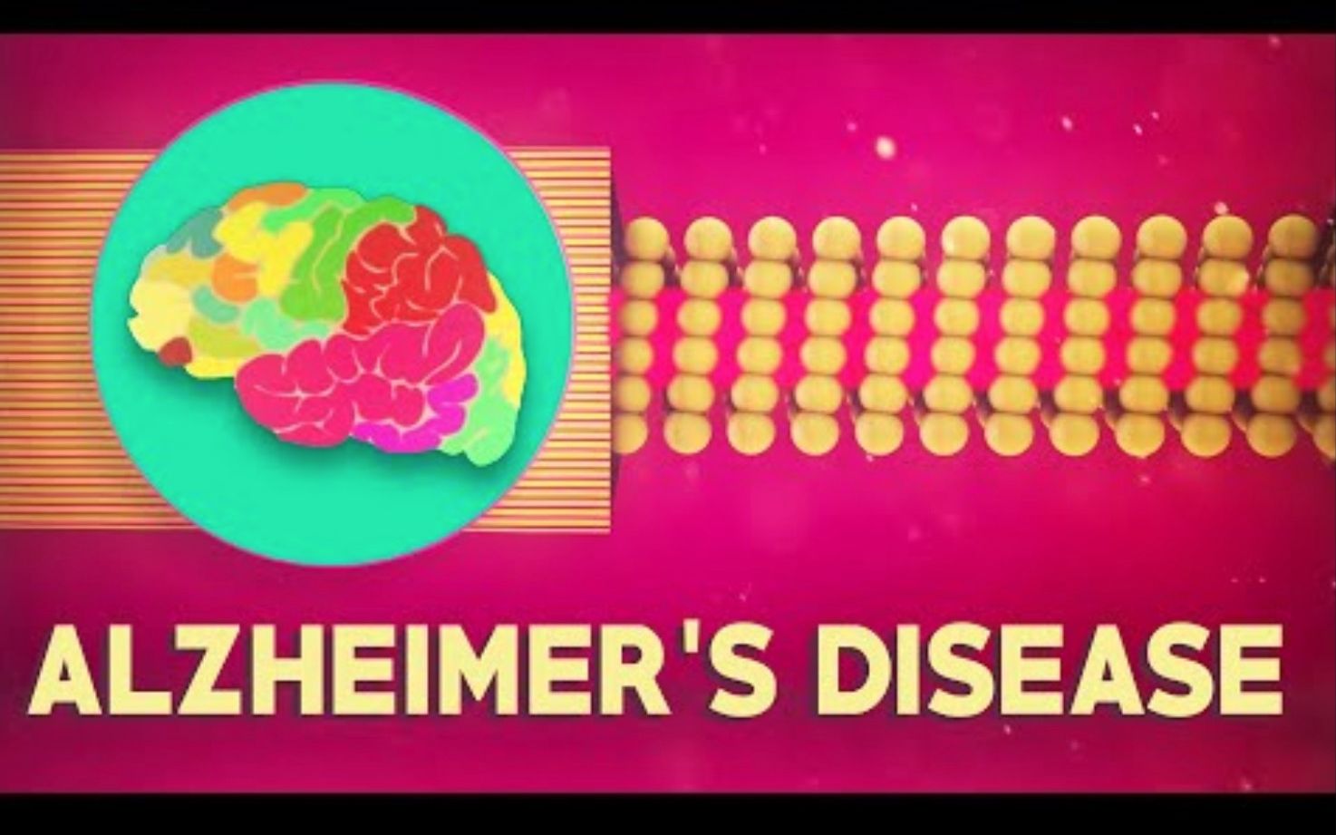 【TedED】什么是阿尔茨海默症 What Is Alzheimer's Disease哔哩哔哩bilibili