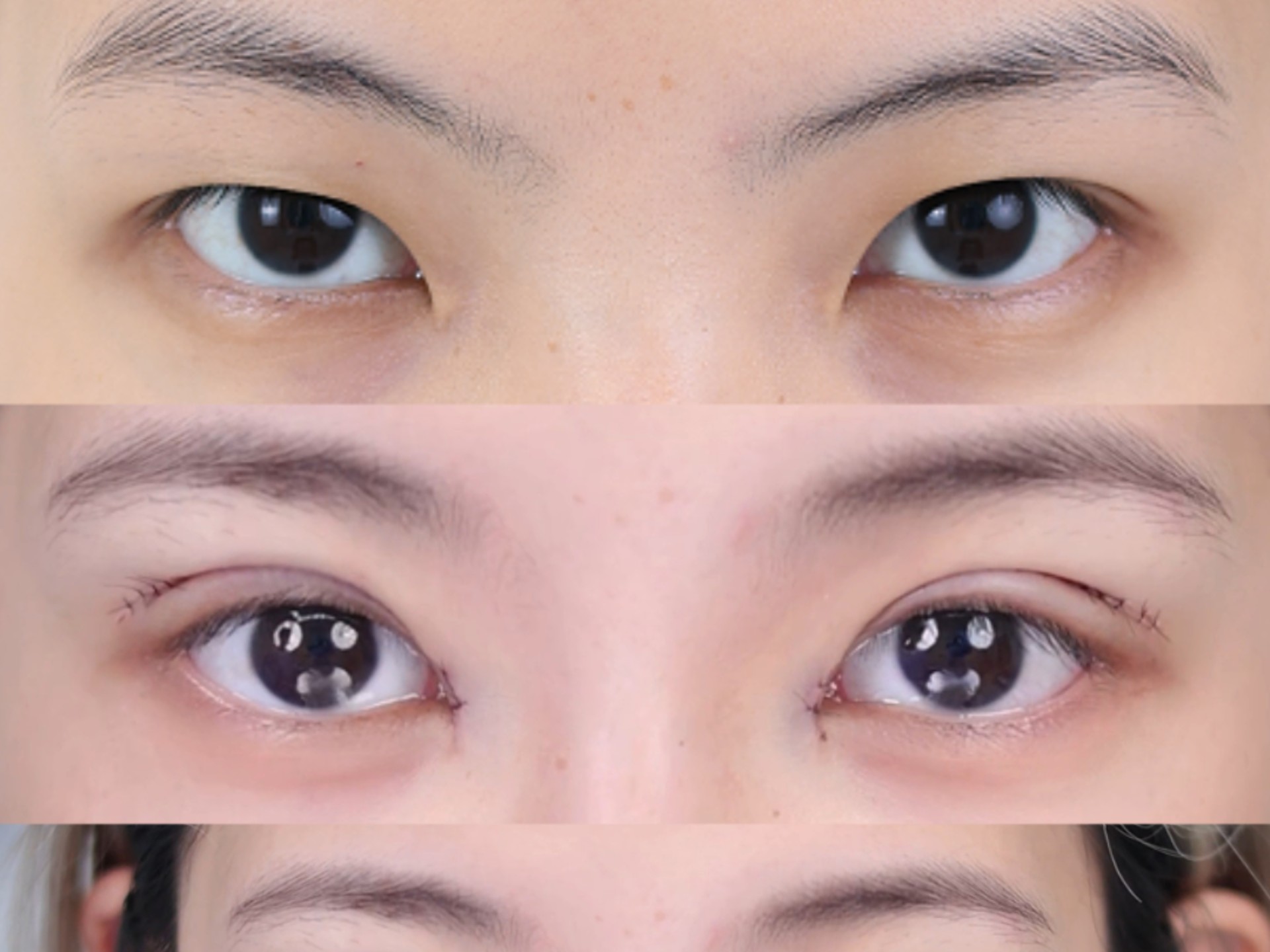 眼睛美貌进阶成功❗这个小姐姐的眼睛有点提肌无力,眼皮比较松弛