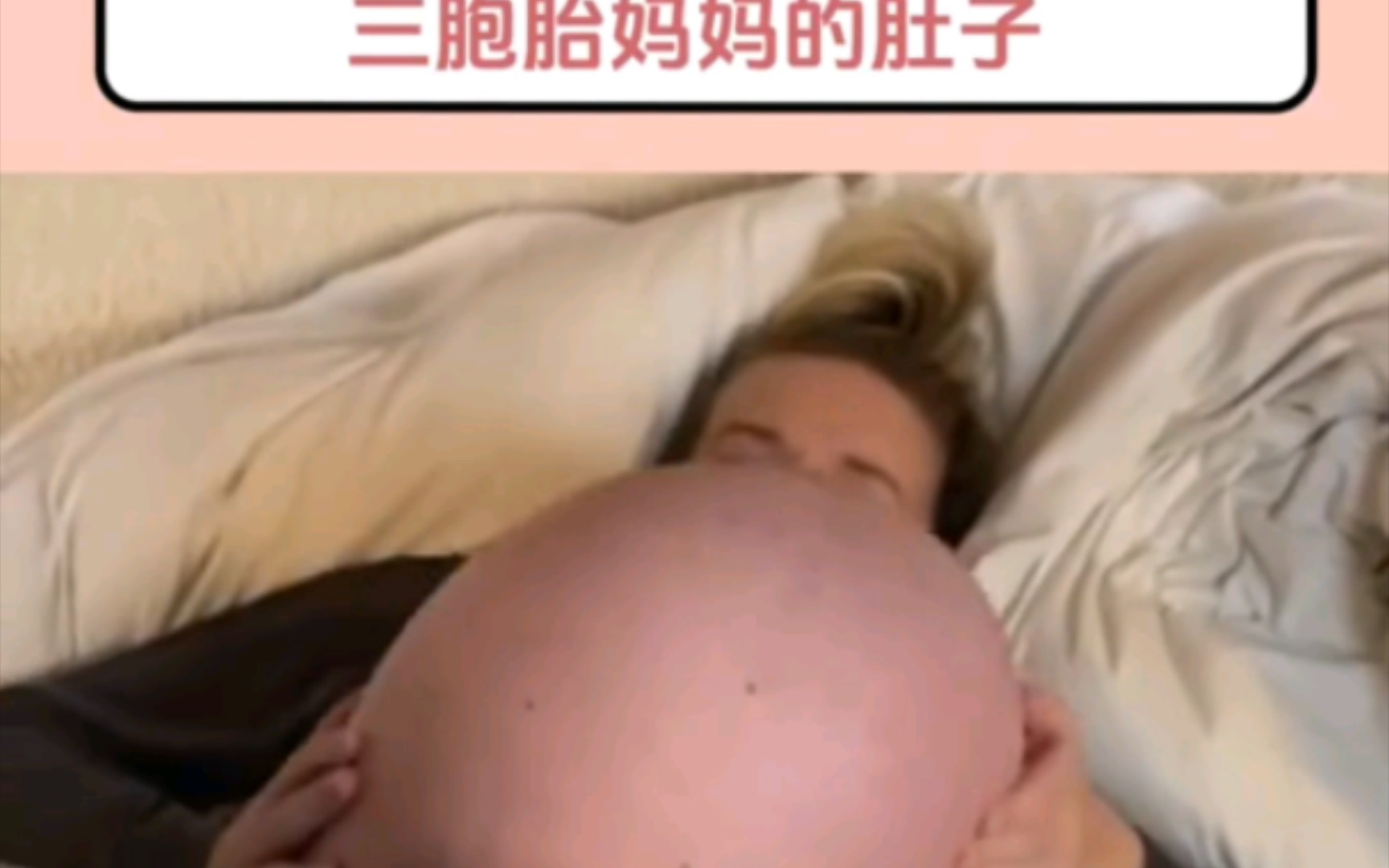 三胞胎孕妈妈的肚子!真的不敢想象,妈妈太伟大了哔哩哔哩bilibili