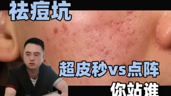 超皮秒vs点阵，祛痘坑你选谁？