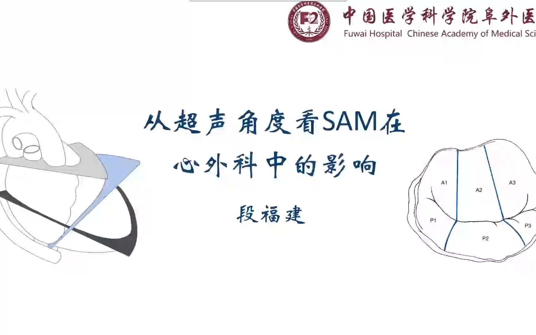 SAM现象的超声视角观察哔哩哔哩bilibili