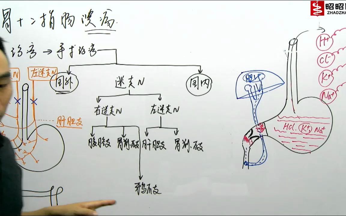 [图]008-消化性溃疡-3（2022课）