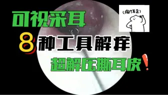 Download Video: 深夜采耳46:全套工具按摩耳膜+清理超多耳皮