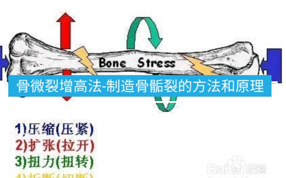 骨微裂增高法制造骨骺裂的方法和原理哔哩哔哩bilibili