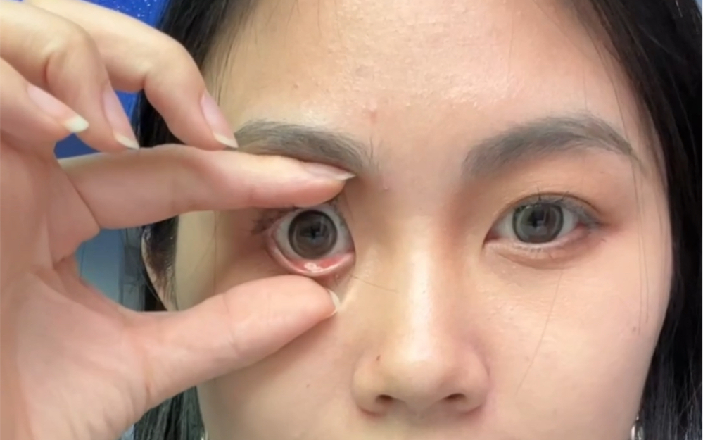 三秒摘美瞳!不用手无菌抠眼珠子教程!