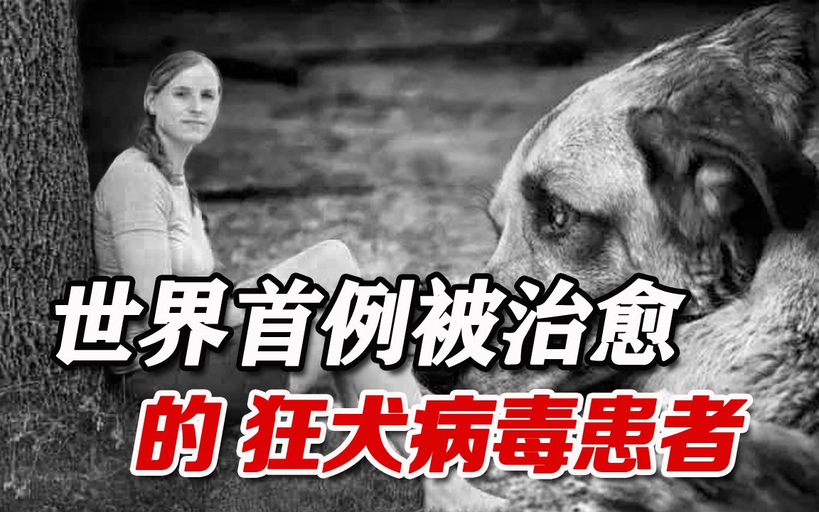 被狗感染的狂犬病毒绝对无一例存活