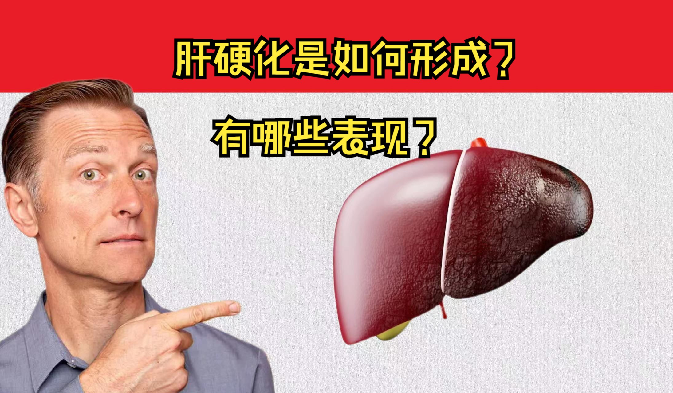 肝硬化是怎么形成的?对人体有哪些影响?终末期有什么表现?哔哩哔哩bilibili