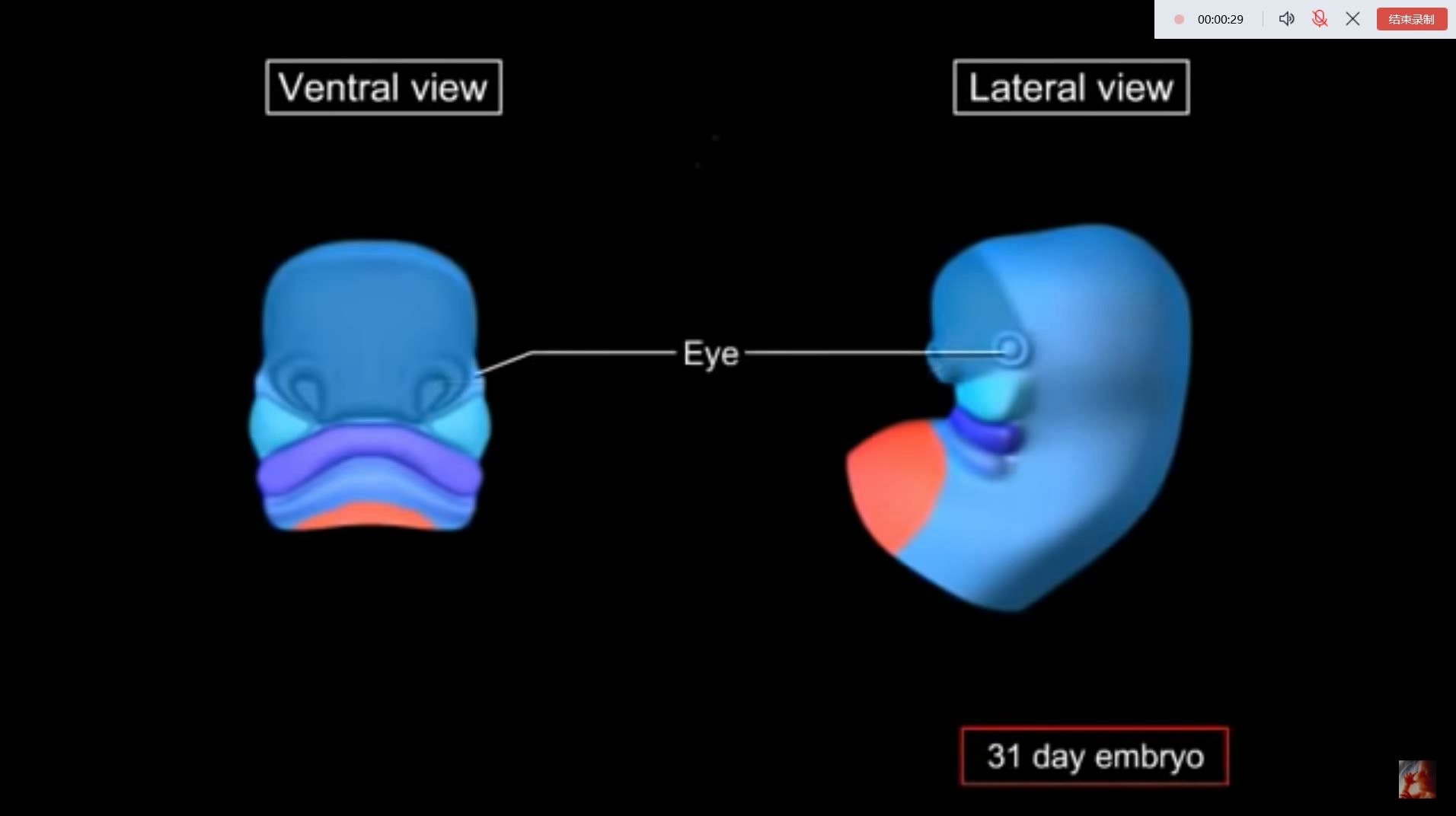 dedvelopment of face 胚胎发育面部的发生 英文版 超详细~哔哩哔哩bilibili