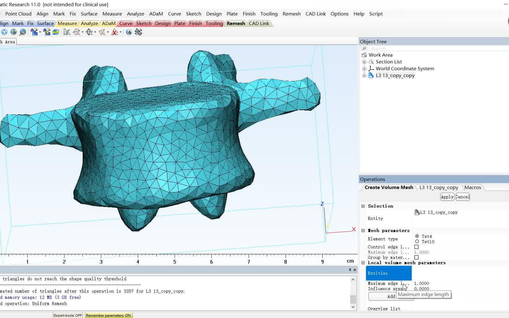 [图]【正式教程】如何从mimics导入文件到ansys workbench/mimics赋财值/3-matic网格划分+Lin东北大学+无字幕