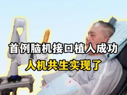 Tải video: 今年，首例人类脑机接口植入成功，知识真能瞬间进入大脑了！！