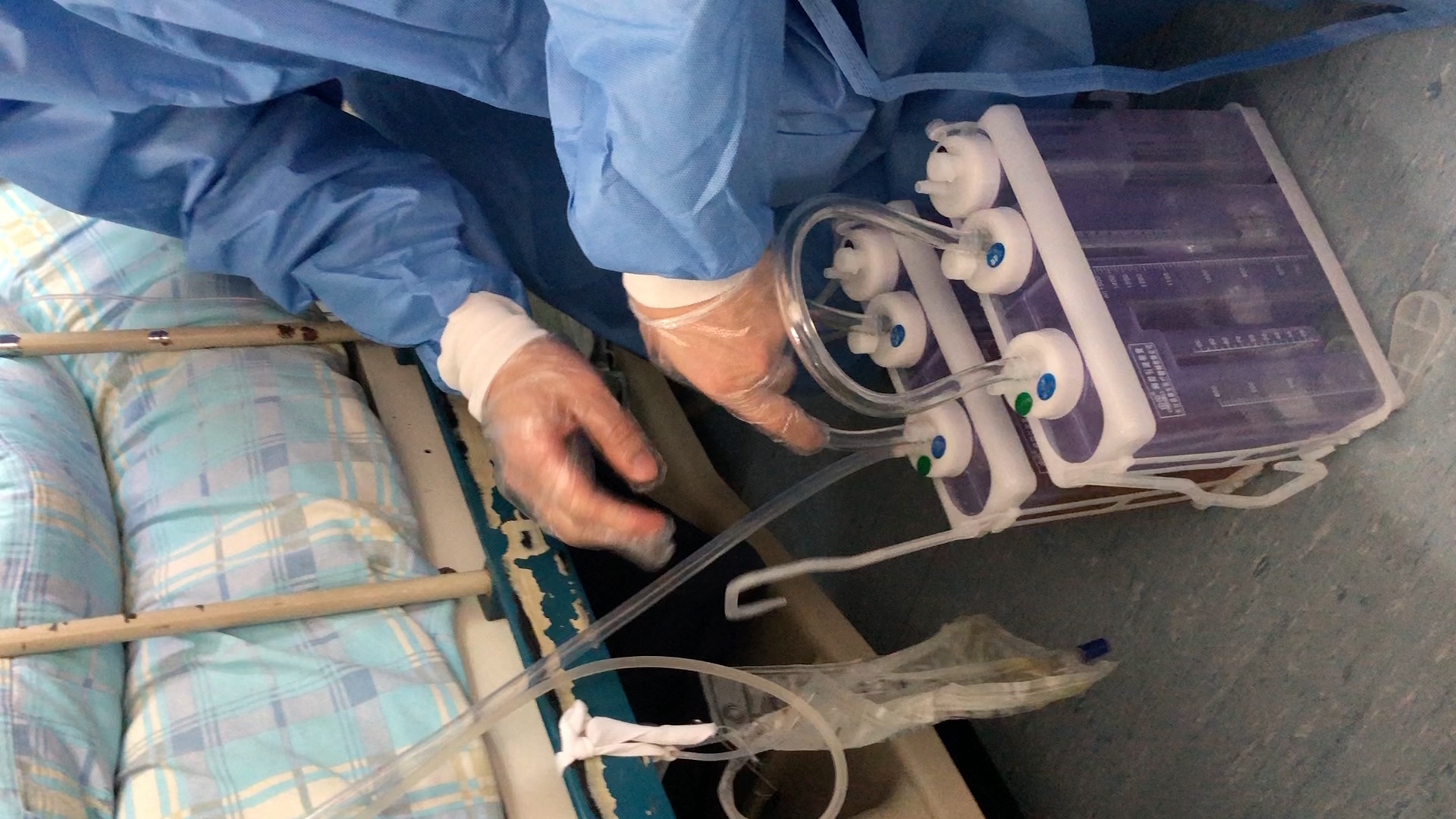 胸外科更换胸瓶