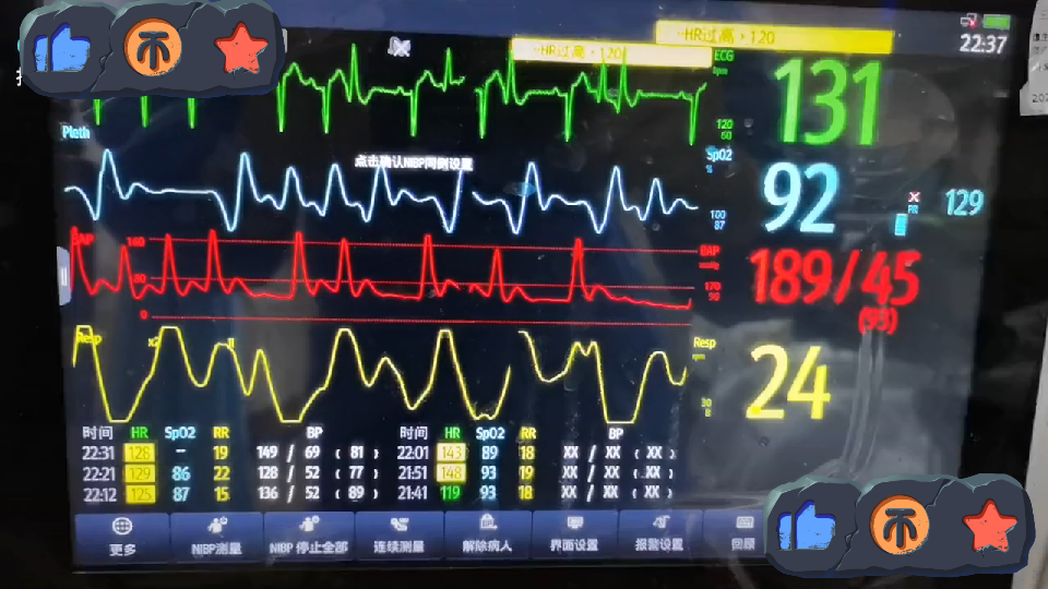 迈瑞异常心电监护仪,有谁知道?哔哩哔哩bilibili