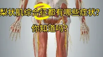 Download Video: 梨状肌综合征到底都有哪些症状？