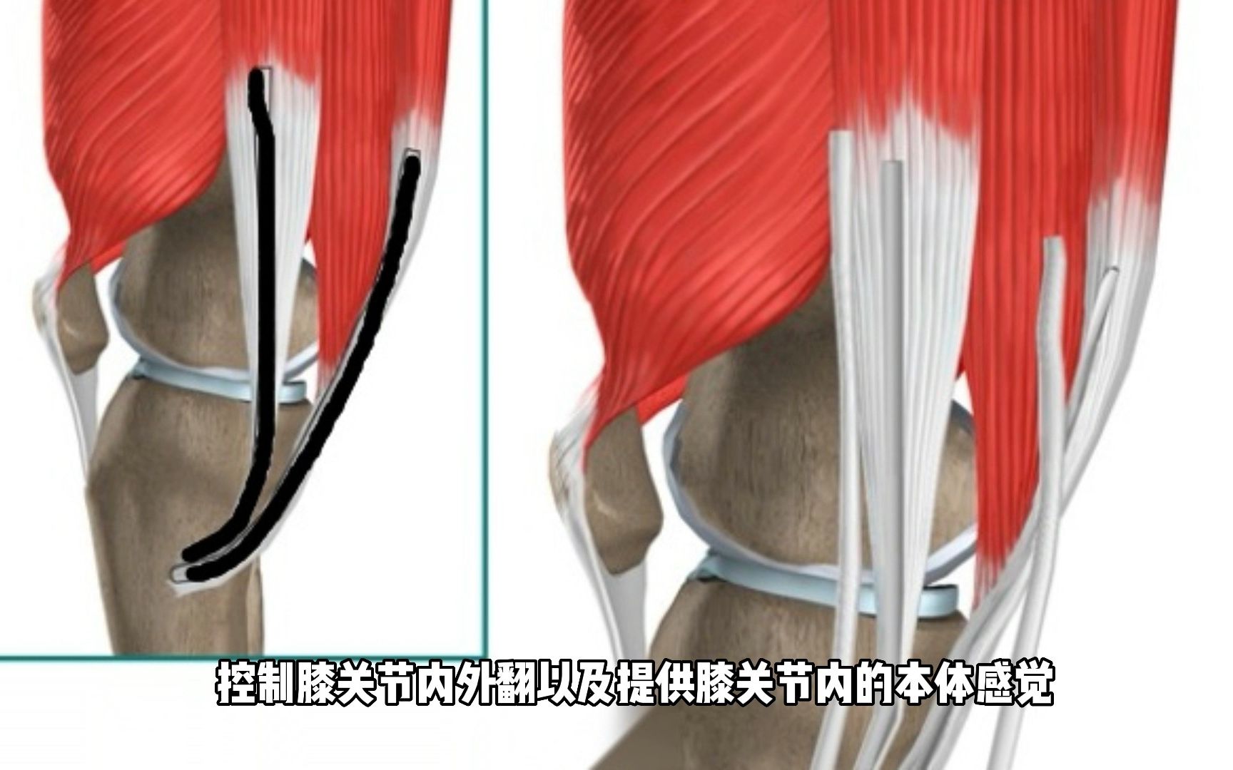 ACL的解剖及功能哔哩哔哩bilibili