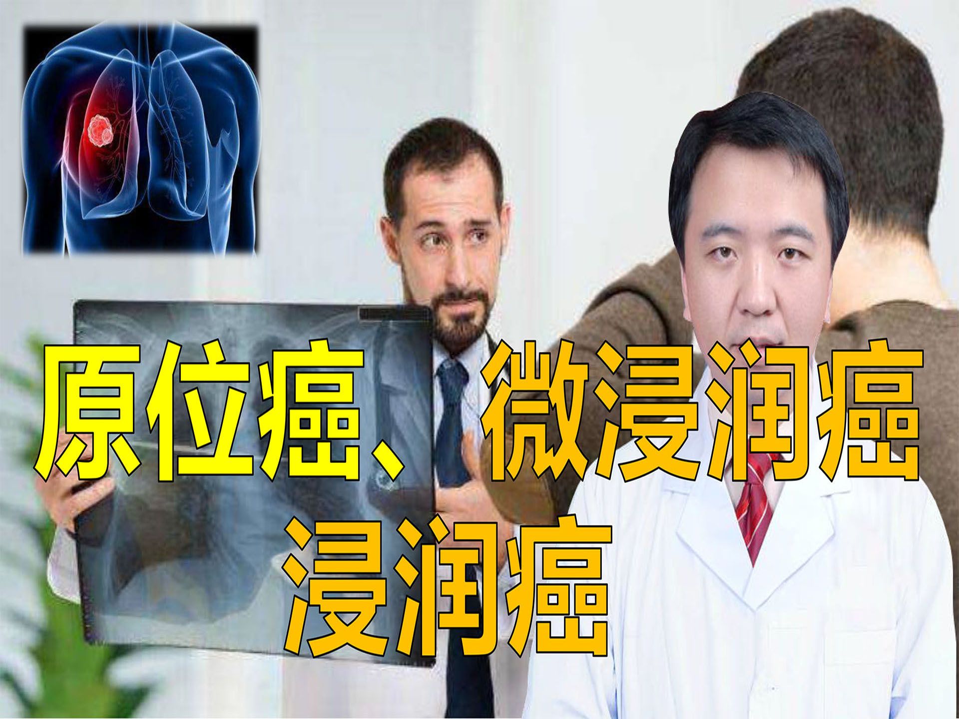 肺腺癌中的原位癌、微浸润癌、浸润癌如何区分?哪个预后好?哪个预后差哔哩哔哩bilibili