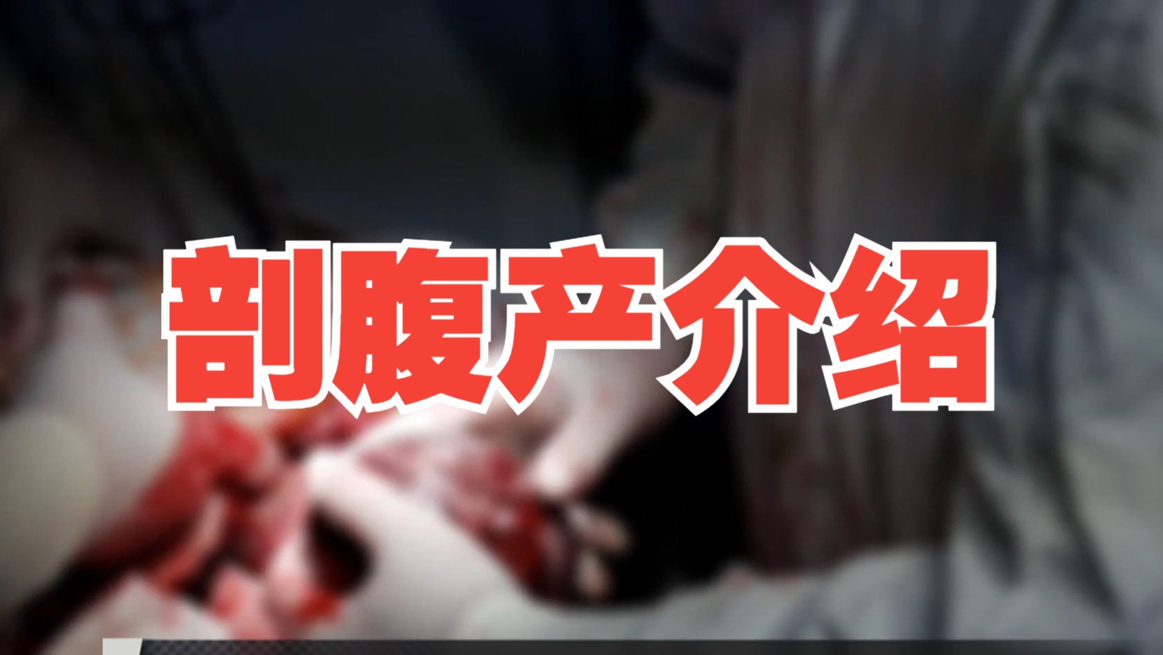 剖腹产有你想的可怕吗?剖腹产全过程介绍哔哩哔哩bilibili