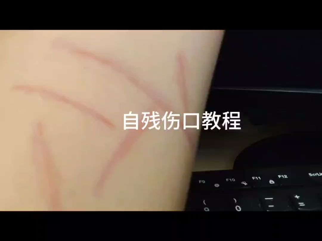 自残伤疤画法哔哩哔哩bilibili