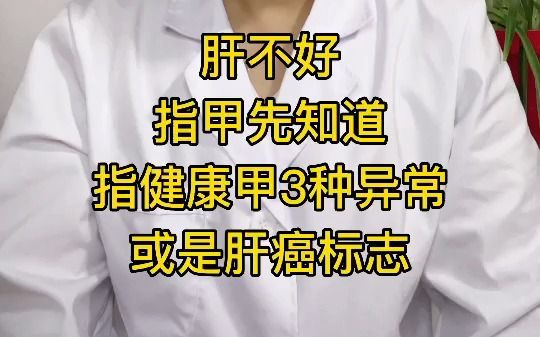 肝不好,指甲先知道,指甲3种异常,或是肝癌标志哔哩哔哩bilibili