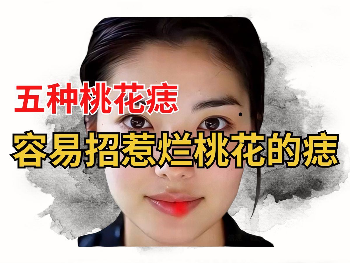 五种桃花痣:容易招惹烂桃花的痣