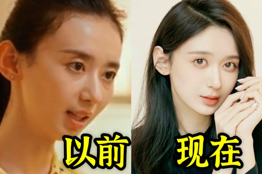 然后转账给她整容么?二十不惑里有徐梓钧最真实的容貌