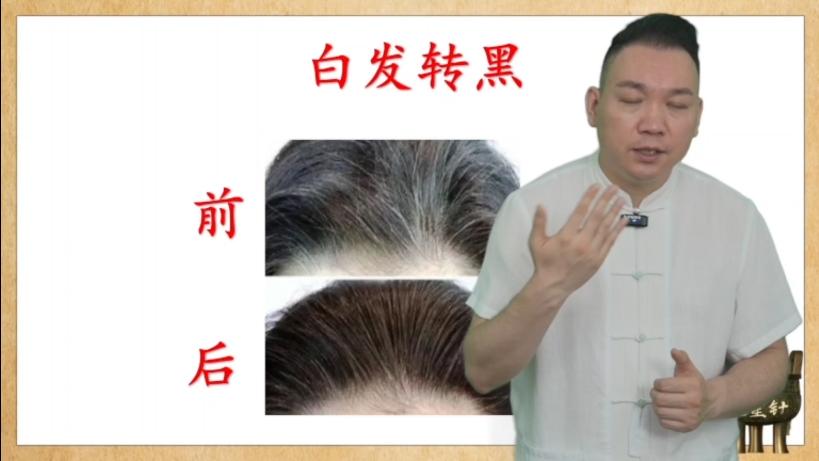 白发转黑!