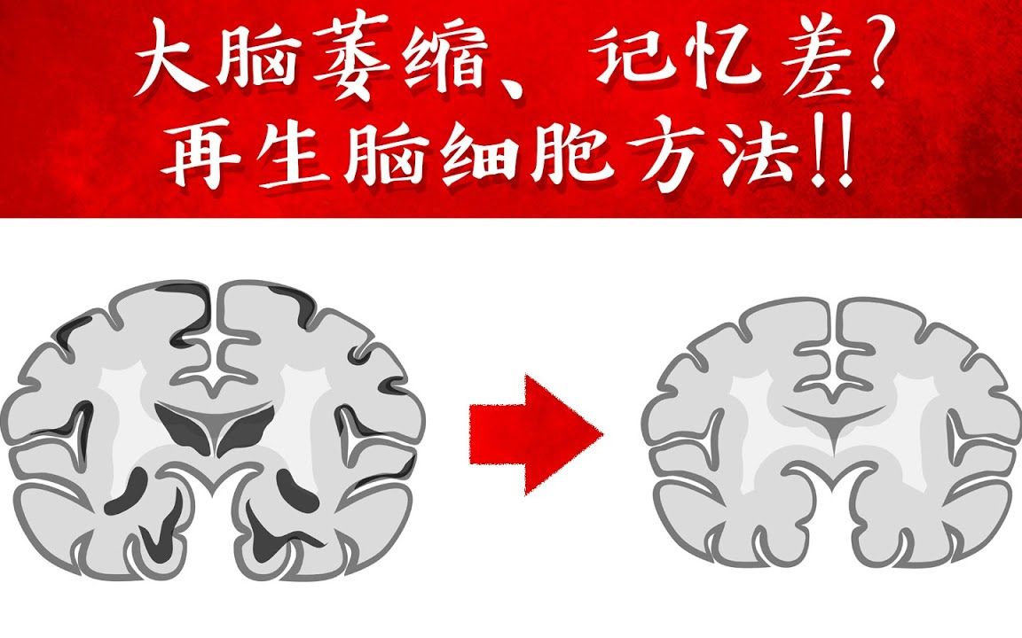 大脑萎缩、记忆差 再生脑细胞方法!!,柏格医生dr berg哔哩哔哩bilibili