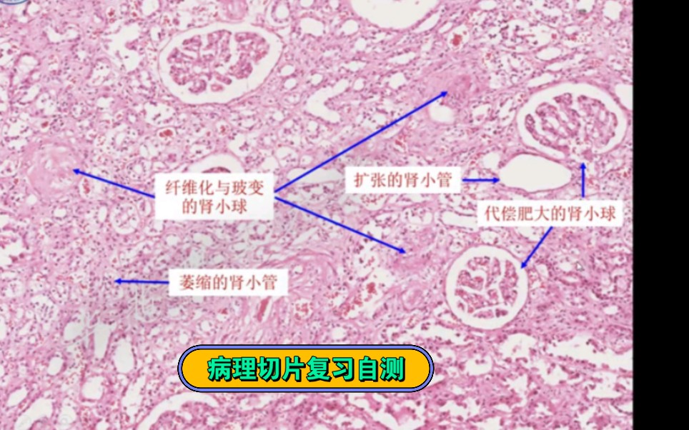 胞内寄生菌图片