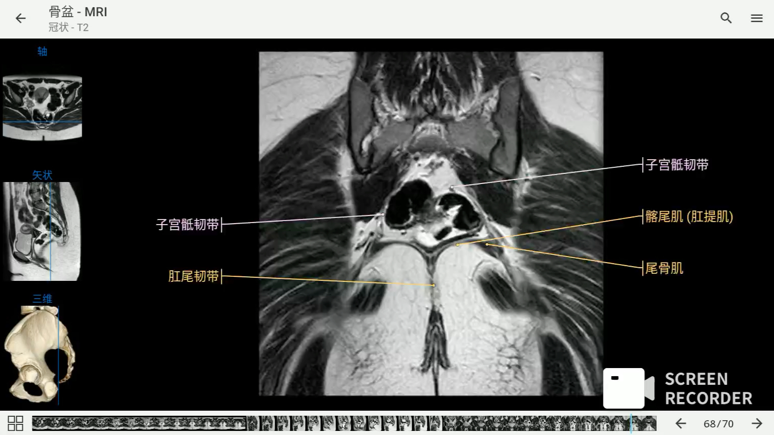 [图]影像解剖图谱神器 医学影像学必备 e-anatomy中文最新版 女性骨盆MRI