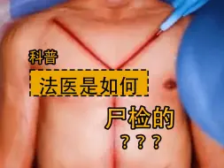 Descargar video: 非正常死亡后，是如何尸检的？