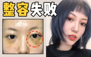 眼袋失败修复 搜索结果 哔哩哔哩 Bilibili