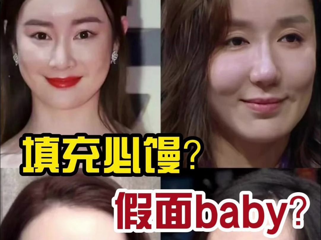 女明星翻车警告!医美填充前必看!错一步丑10年