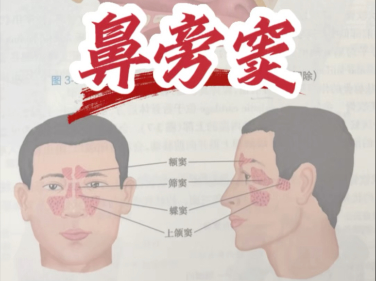 在《系统解剖学》课本上讲解剖:鼻旁窦