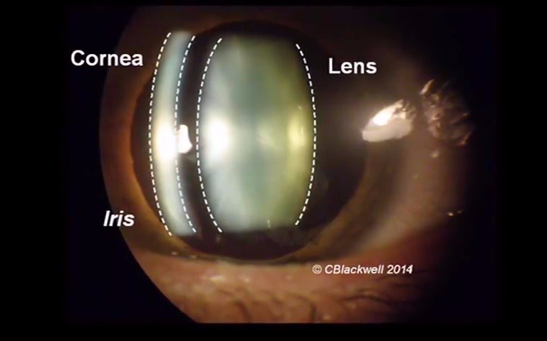 眼科知识每日一学:2. CorneaA Remarkable Structure哔哩哔哩bilibili