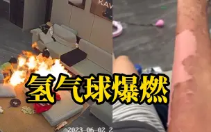 下载视频: 小孩玩氢气球时碰到吹风机瞬间爆燃，妈妈被烧伤