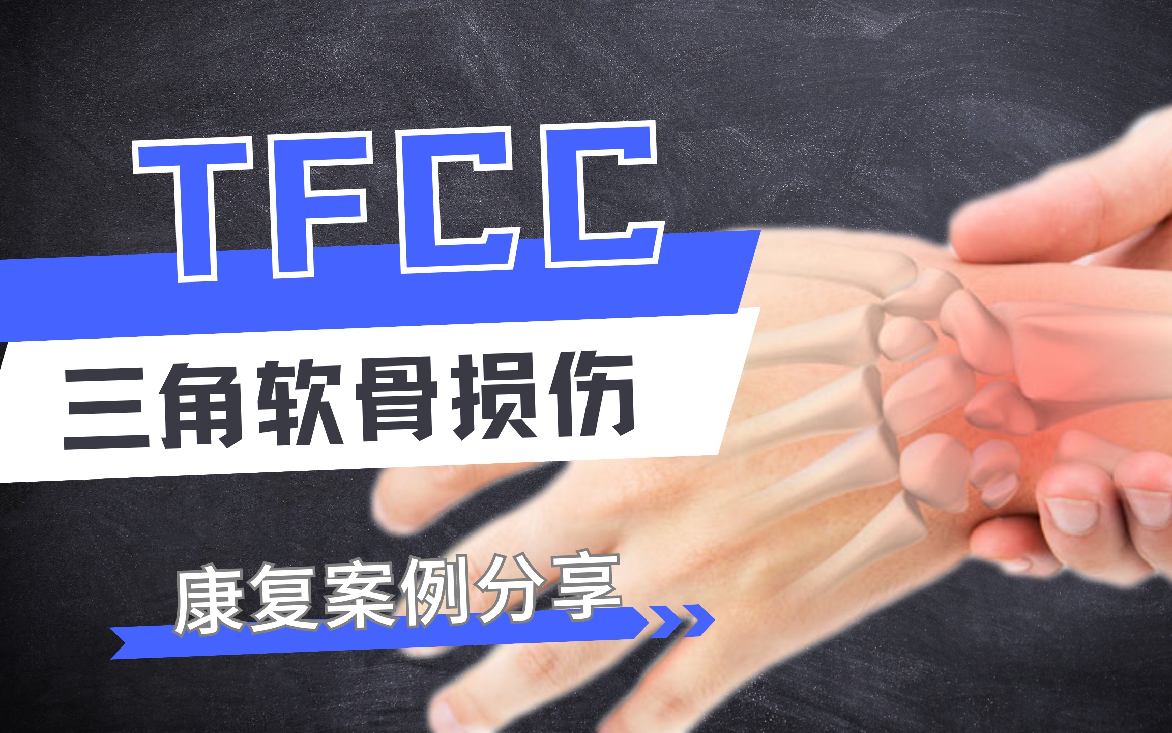 【运动康复】tfcc手腕三角软骨损伤 处理思路分享