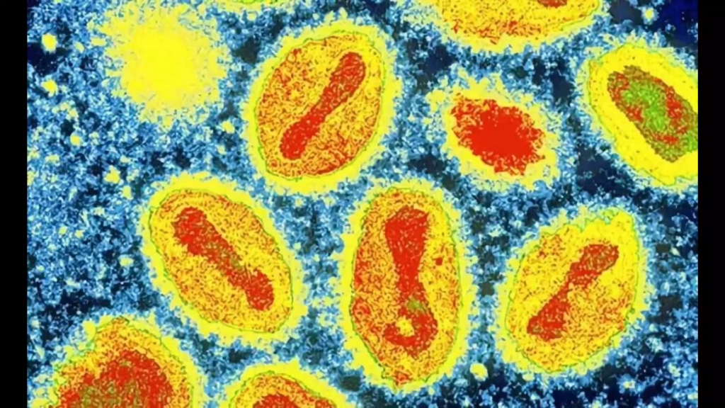 学生作业:人痘接种术与牛痘接种术