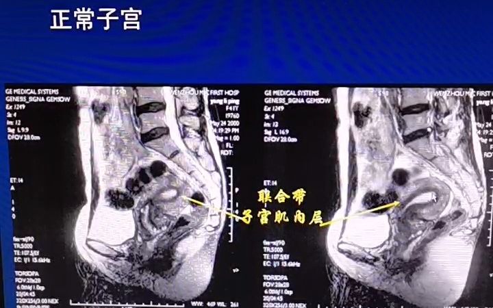 [图]温州医科大学医学影像诊断学课程（温州附二院陈伟）—生殖系统