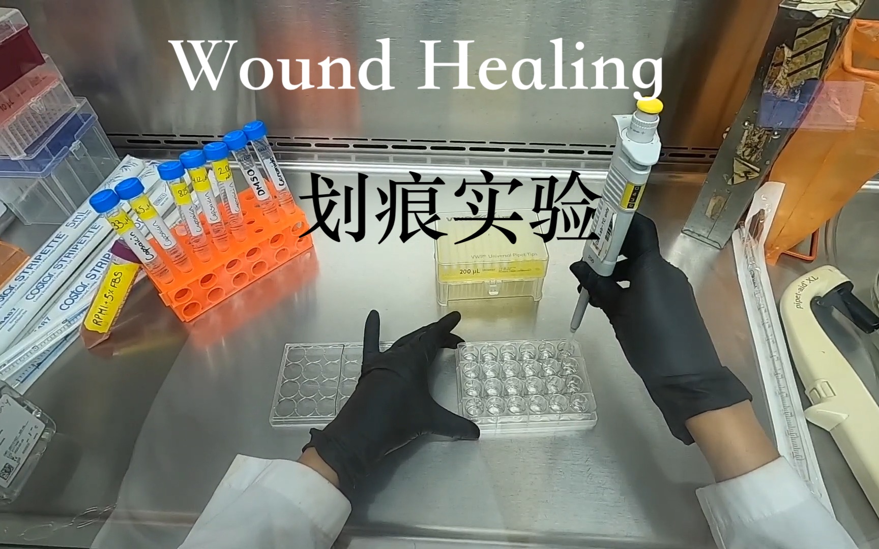 划痕实验Wound healing哔哩哔哩bilibili