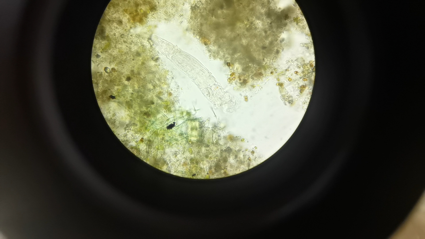 显微镜下的轮虫