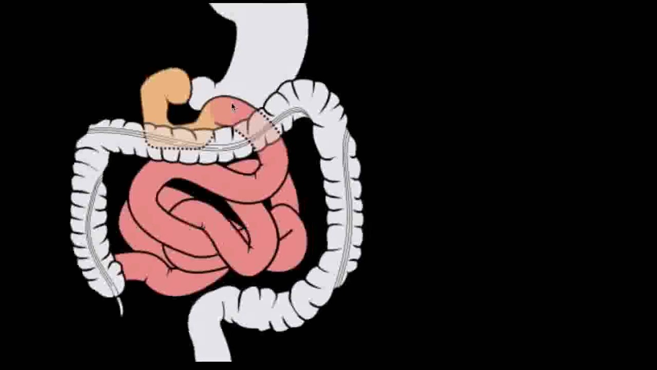 【搬运KhanAcademy】消化系统——Small intestine 1: Structure哔哩哔哩bilibili